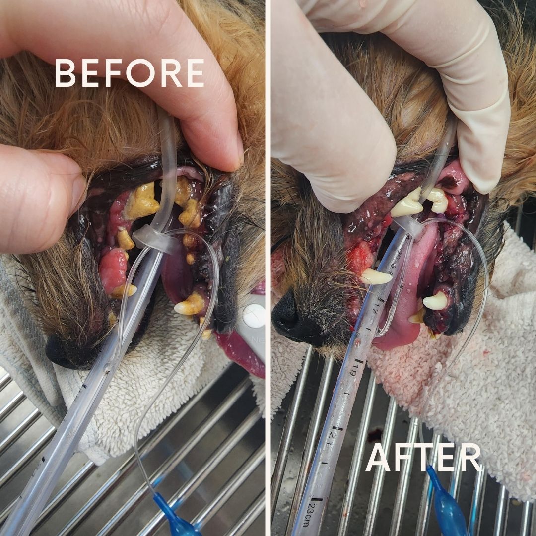 Dental Before And After