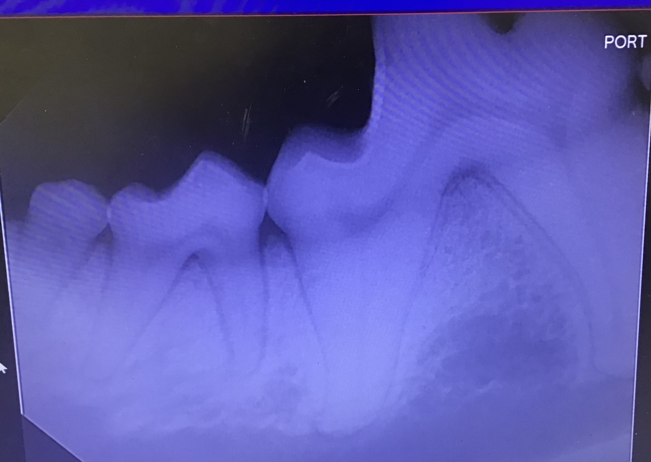 dental xray